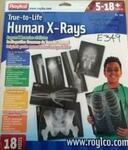 HUMAN X RAYS