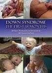 Down Syndrome the first 18 months